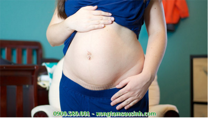 Cần lưu ý vết mổ sau sinh để tránh không cho vết mổ nhiễm trùng